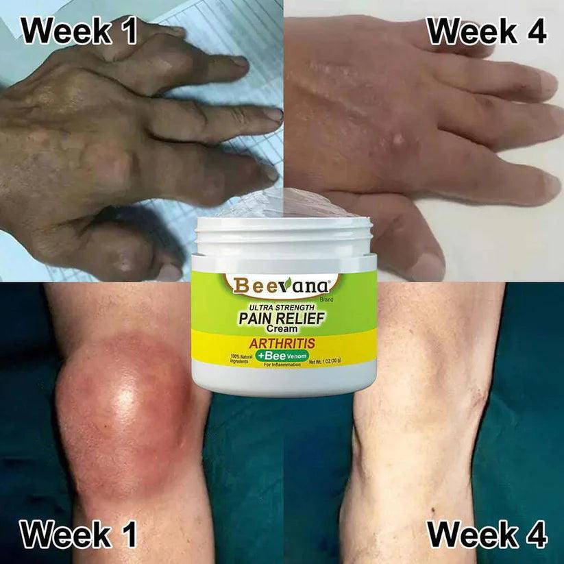 𝐎𝐑𝐈𝐆𝐈𝐍𝐀𝐋™ 𝐁𝐞𝐞 𝐕𝐞𝐧𝐨𝐦 𝐉𝐨𝐢𝐧𝐭 𝐚𝐧𝐝 𝐁𝐨𝐧𝐞 𝐓𝐡𝐞𝐫𝐚𝐩𝐲 𝐂𝐫𝐞𝐚𝐦 🐝(🔥𝐁𝐔𝐘 1 𝐆𝐄𝐓 2 𝐅𝐑𝐄𝐄🔥) 𝐓𝐫𝐮𝐬𝐭𝐞𝐝 𝐛𝐲 50,000+ 𝐇𝐚𝐩𝐩𝐲 𝐂𝐮𝐬𝐭𝐨𝐦𝐞𝐫𝐬
